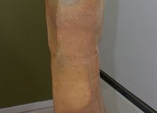 House Series 1978-1985 Do Gon